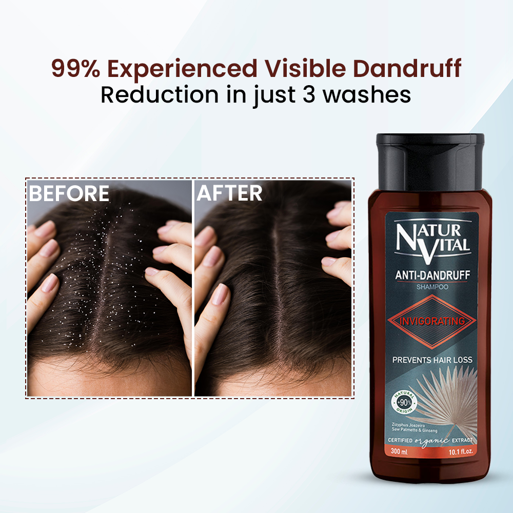 Invigorating Anti-Dandruff Shampoo - 6