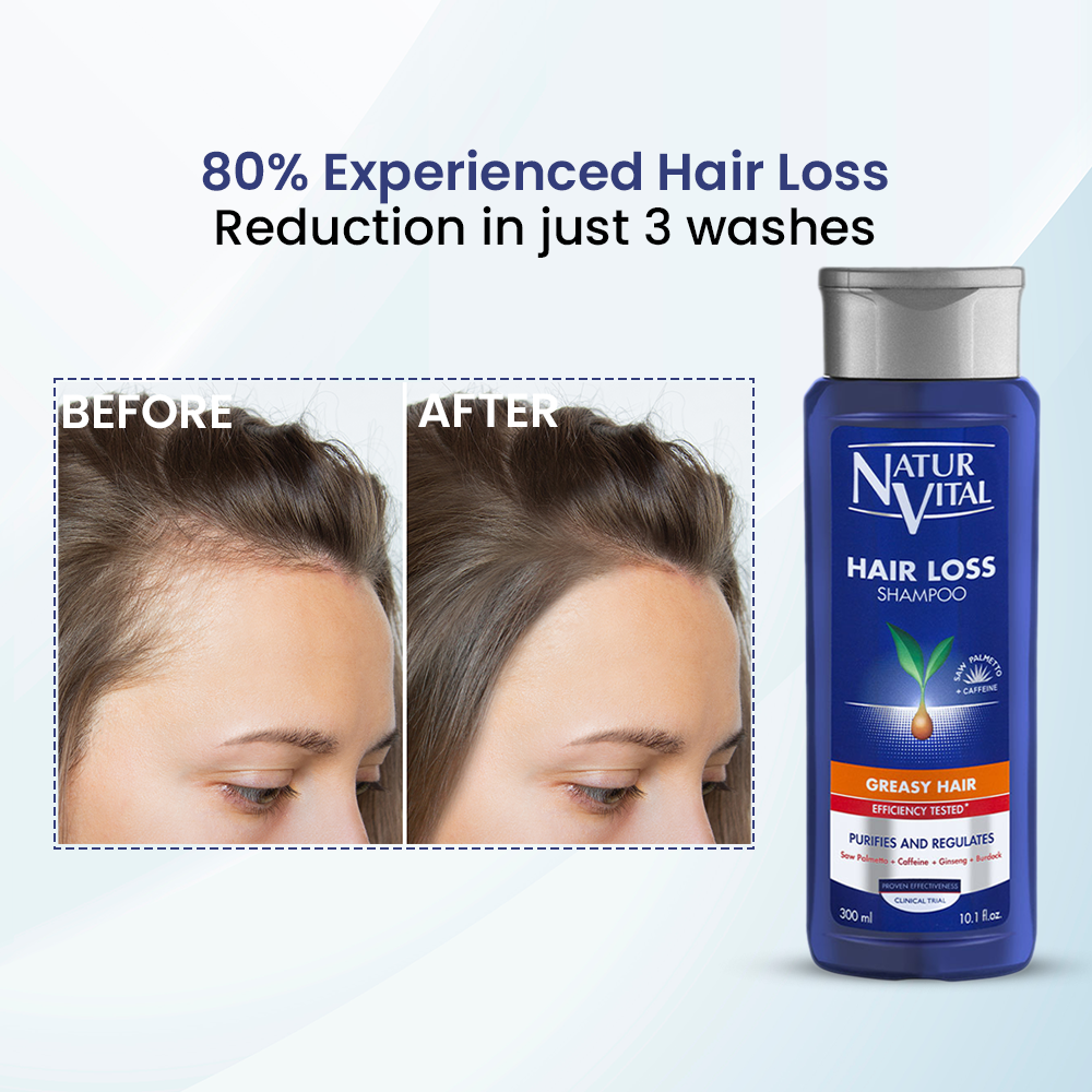 Hair Loss Shampoo for Greasy Hair - 6