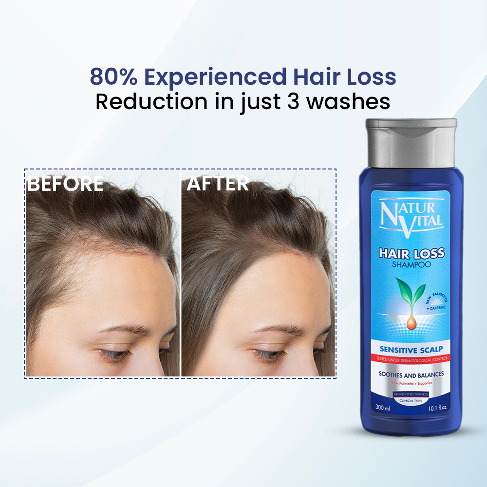 Sensitive Hair Loss Shampoo - 6